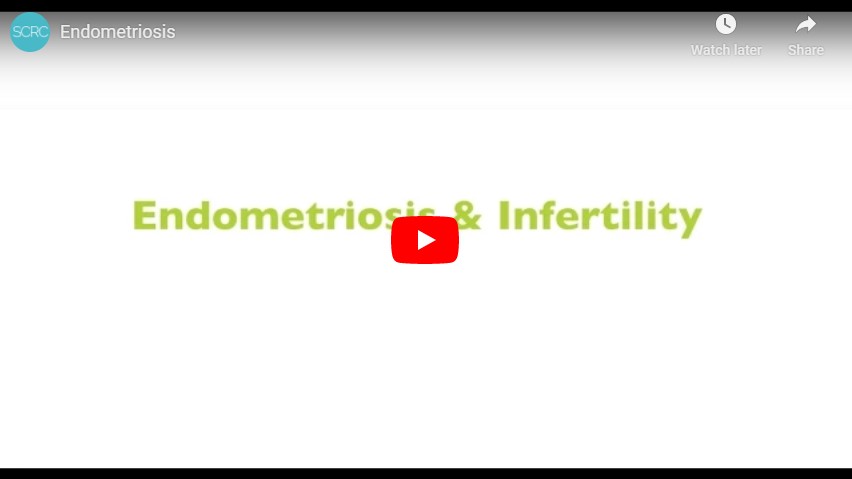 Endometriosis infertility and IVF 