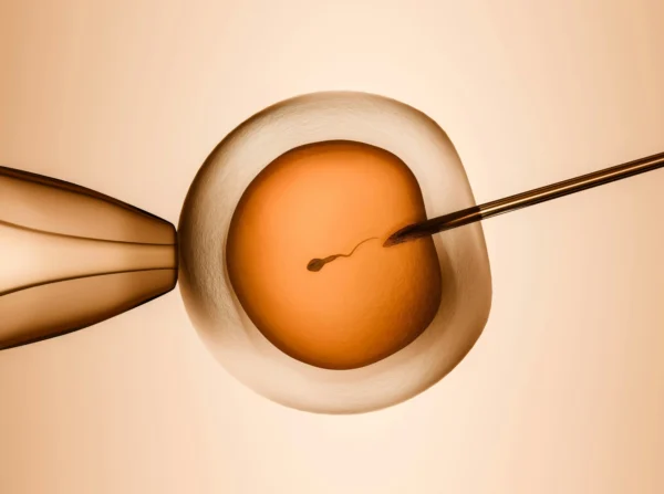 What Are My Options After a Failed IVF Cycle?
